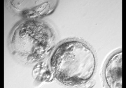 stemcell-1305171827_4_3_rx383_c540x380